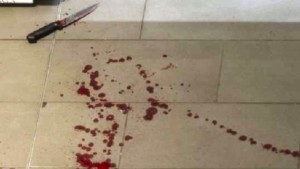 sangue in casa