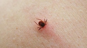 puntura di zecca