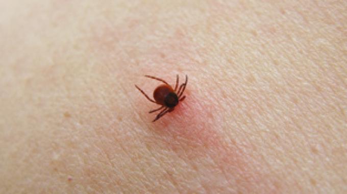 puntura di zecca