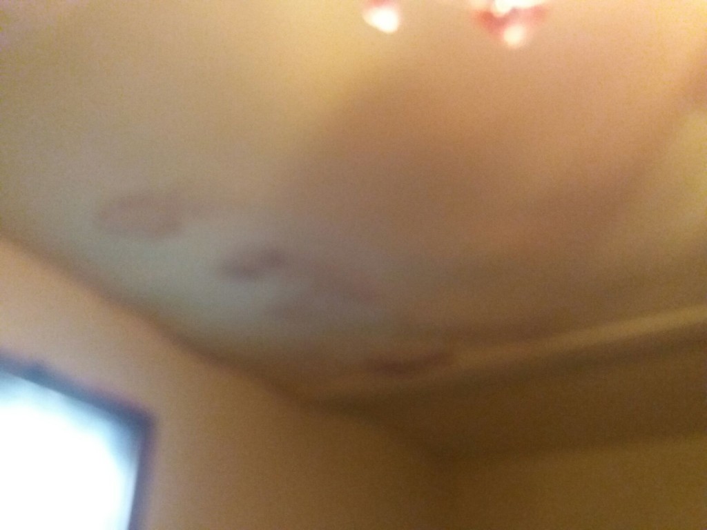 baracche zir messina