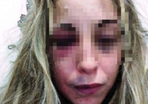 UMBRIA RAGAZZA PICCHIATA