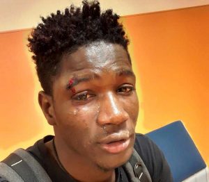 RAGAZZO DI COLORE AGGREDITO PALERMO