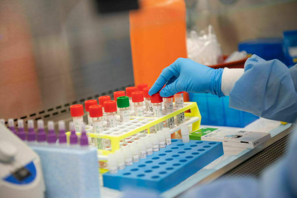 Long Island Laboratory To Start Semi-Automated Coronavirus Testing