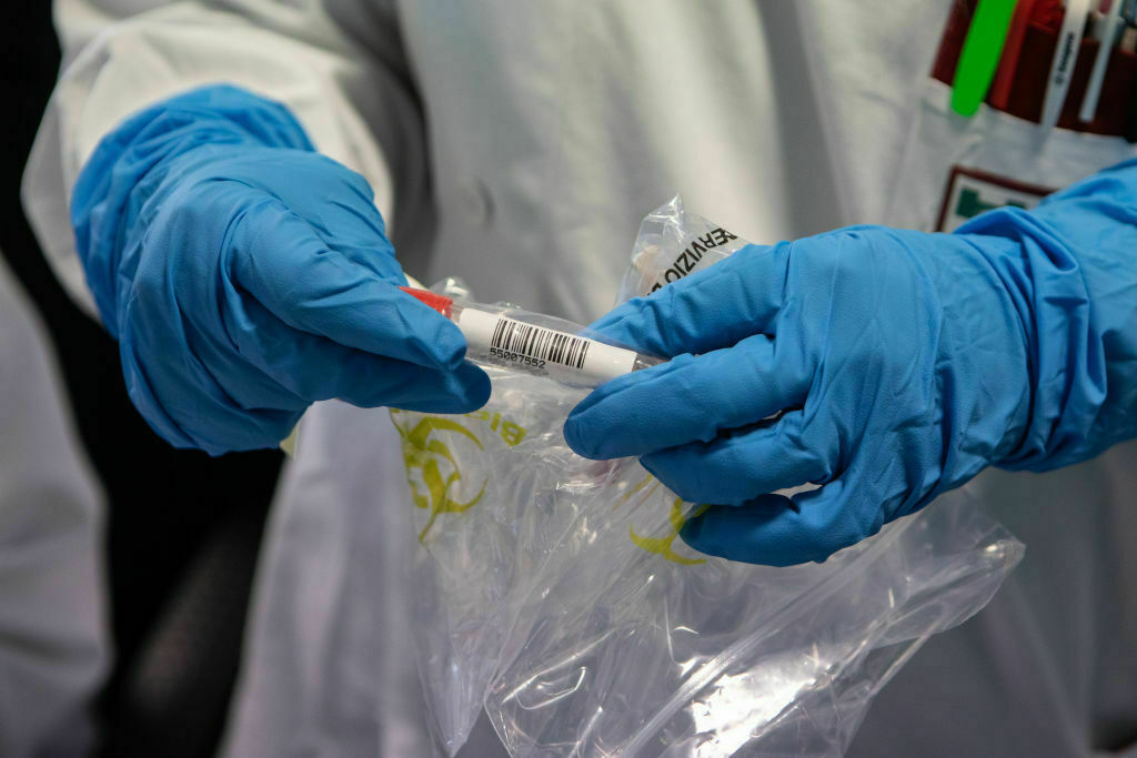 Swabs Are Tested For Coronavirus At Milan Laboratory