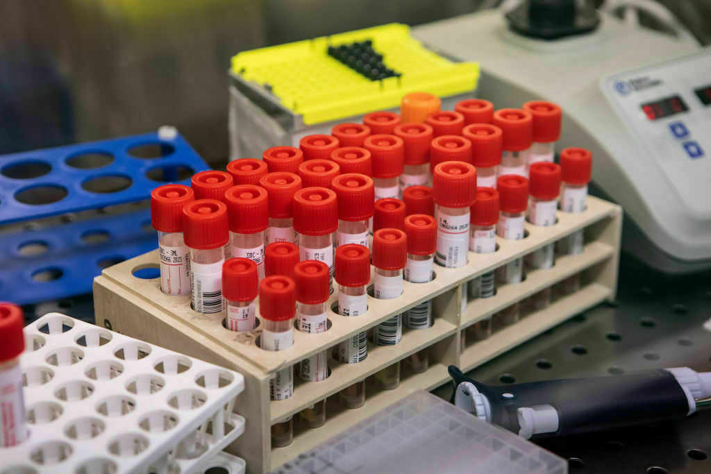 Swabs Are Tested For Coronavirus At Milan Laboratory