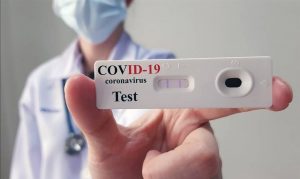 test sierologico coronavirus