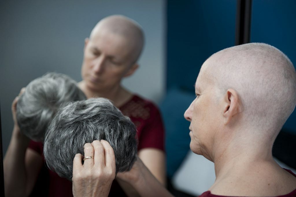 parrucche oncologiche