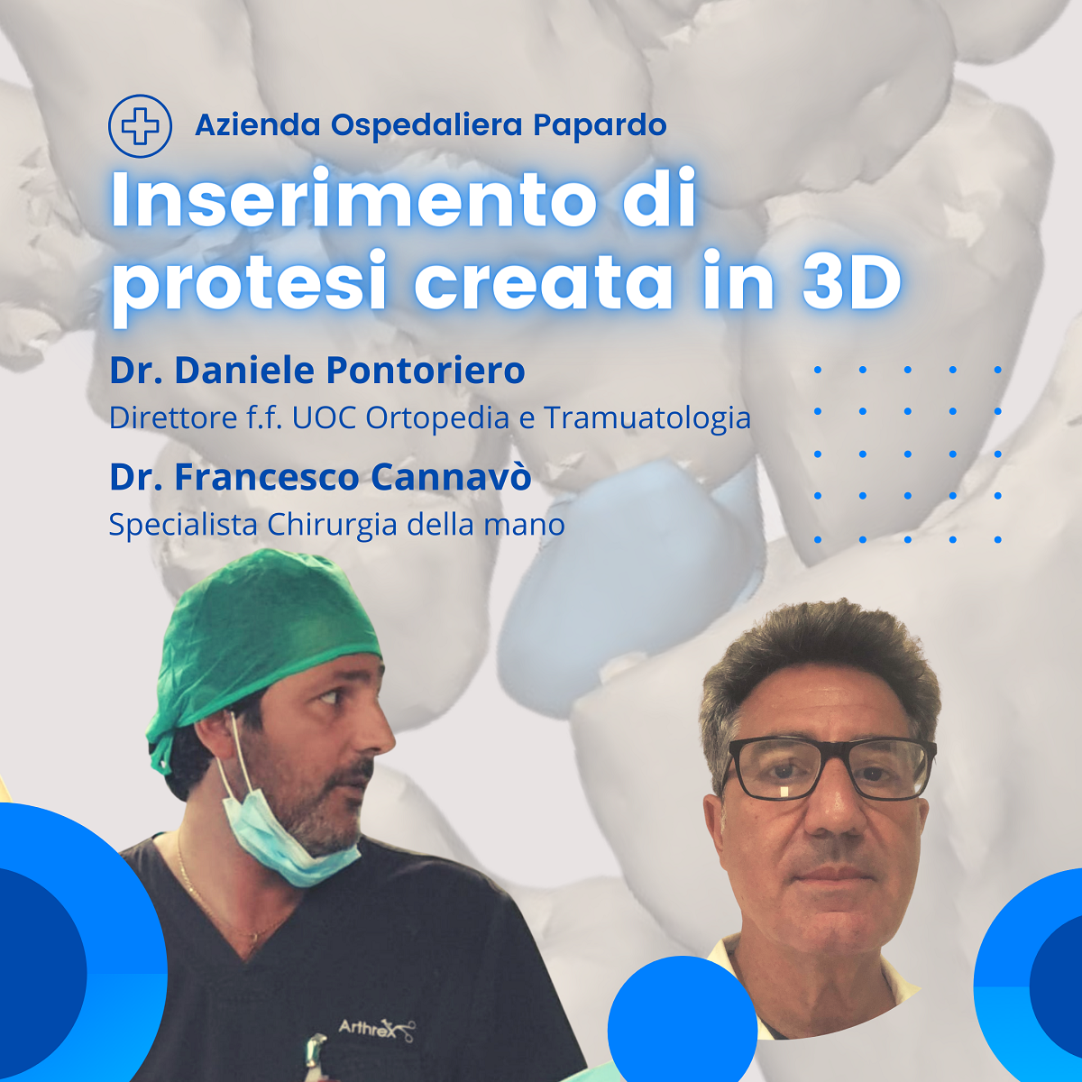 Intervento di protesi creata in 3D