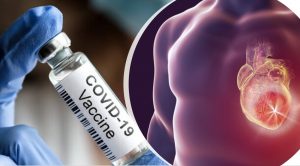 miocardite vaccino covid