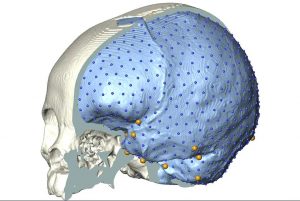 cervello homo sapiens