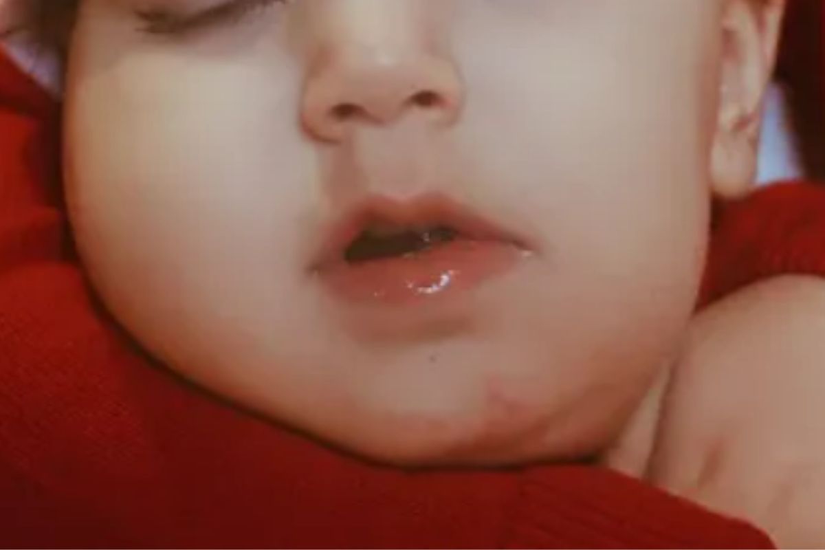 bambina ida acri