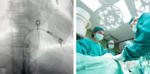 sala operatoria intervento pacemaker