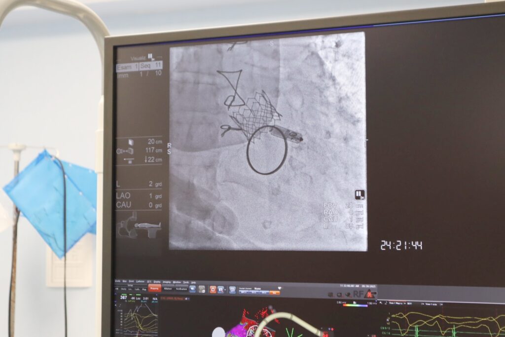 Inaugurazione Angiografi Gom