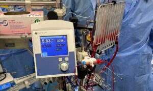 Sanità Dulbecco Catanzaro
