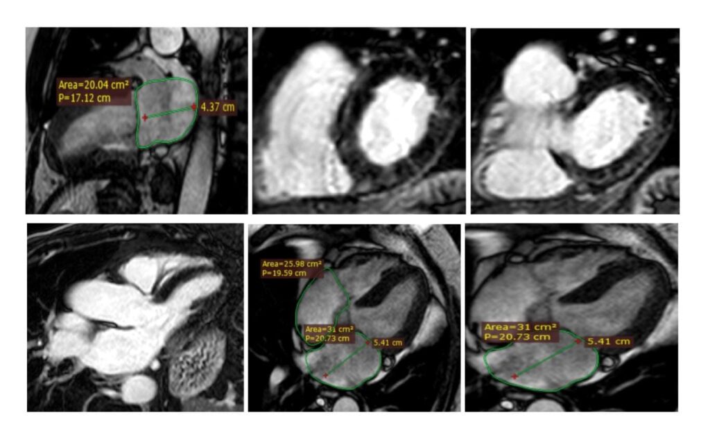 immagine cardiorisonanza Barcellona P.G.