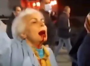 Donna ferita proteste Iran