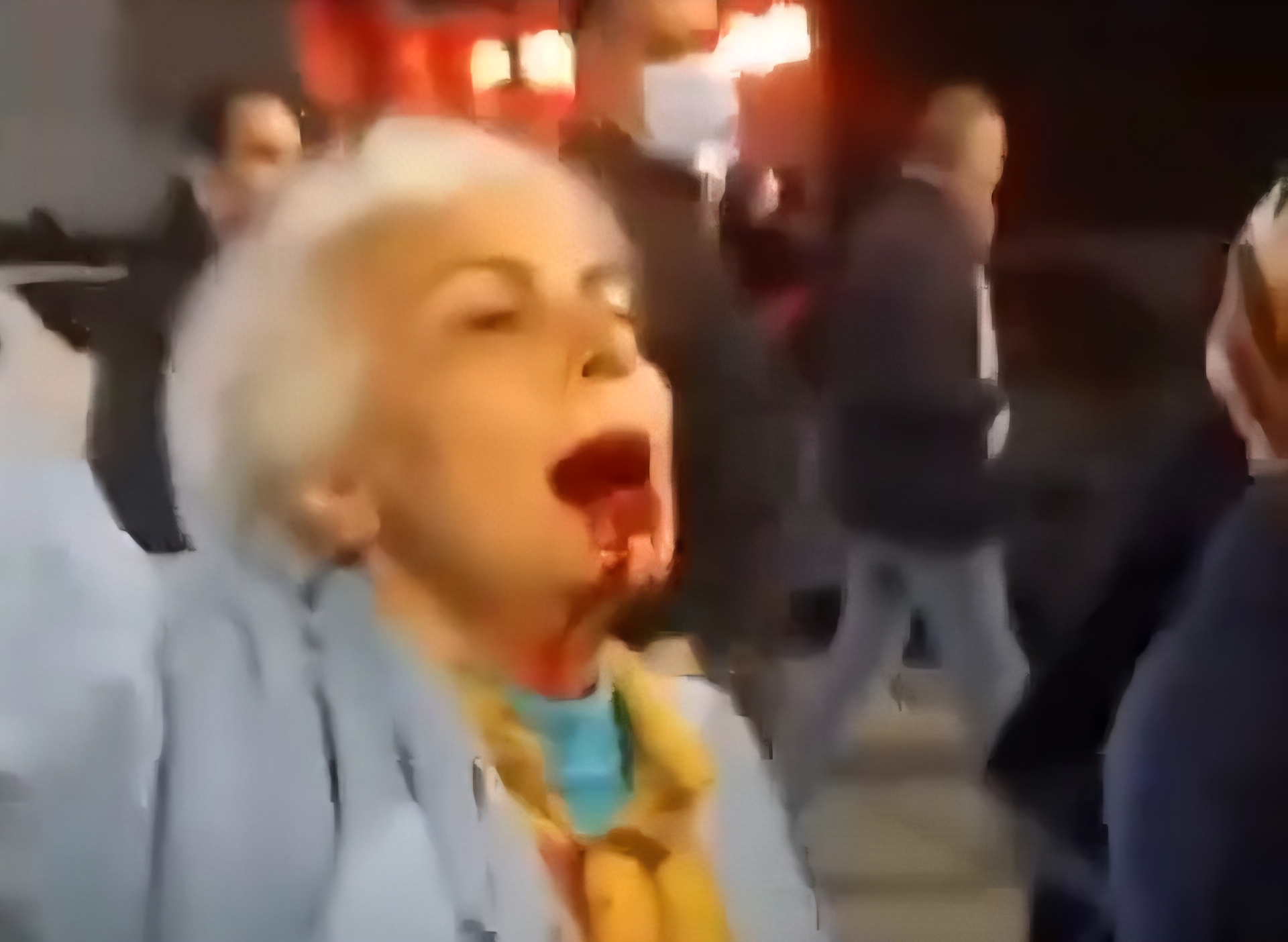 Donna ferita proteste Iran