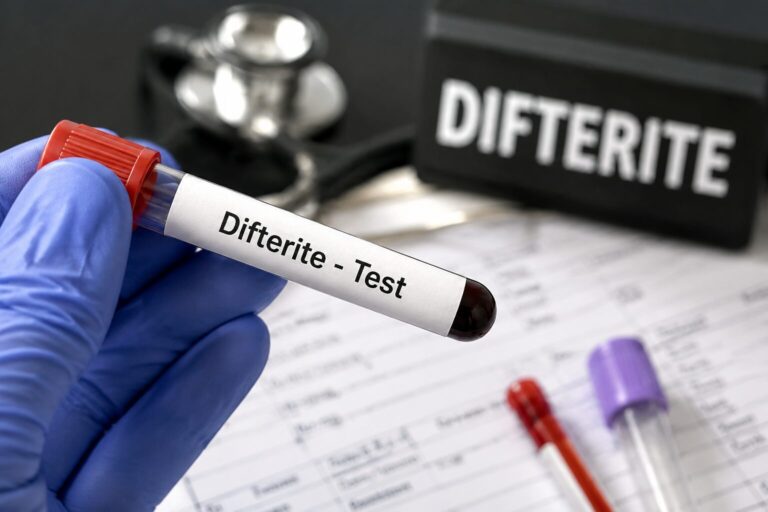 Test per la difterite