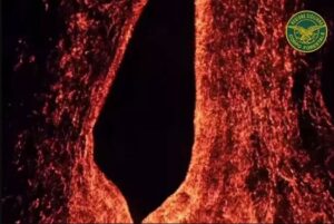 etna